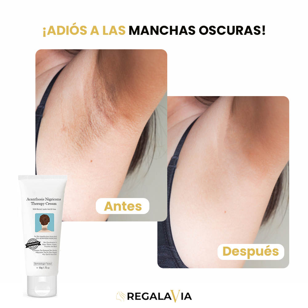 1+1 GRATIS ACANTHOSIS™ | EL SECRETO NATURAL PARA UNA PIEL SIN MANCHAS