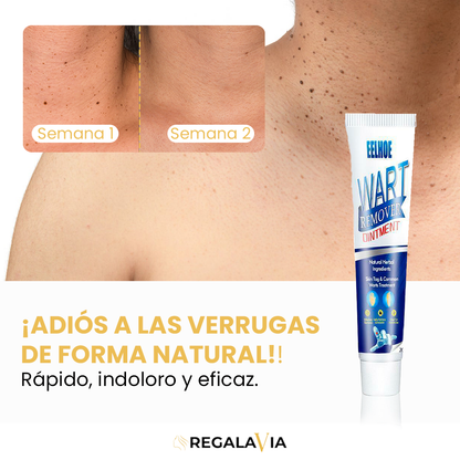 1+1 GRATIS Wart Remover™ | Eliminación Efectiva, Resultados Visibles