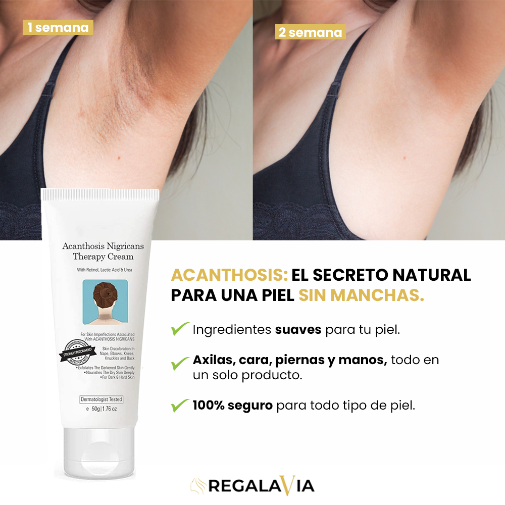 1+1 GRATIS   ACANTHOSIS™ | EL SECRETO NATURAL PARA UNA PIEL SIN MANCHAS