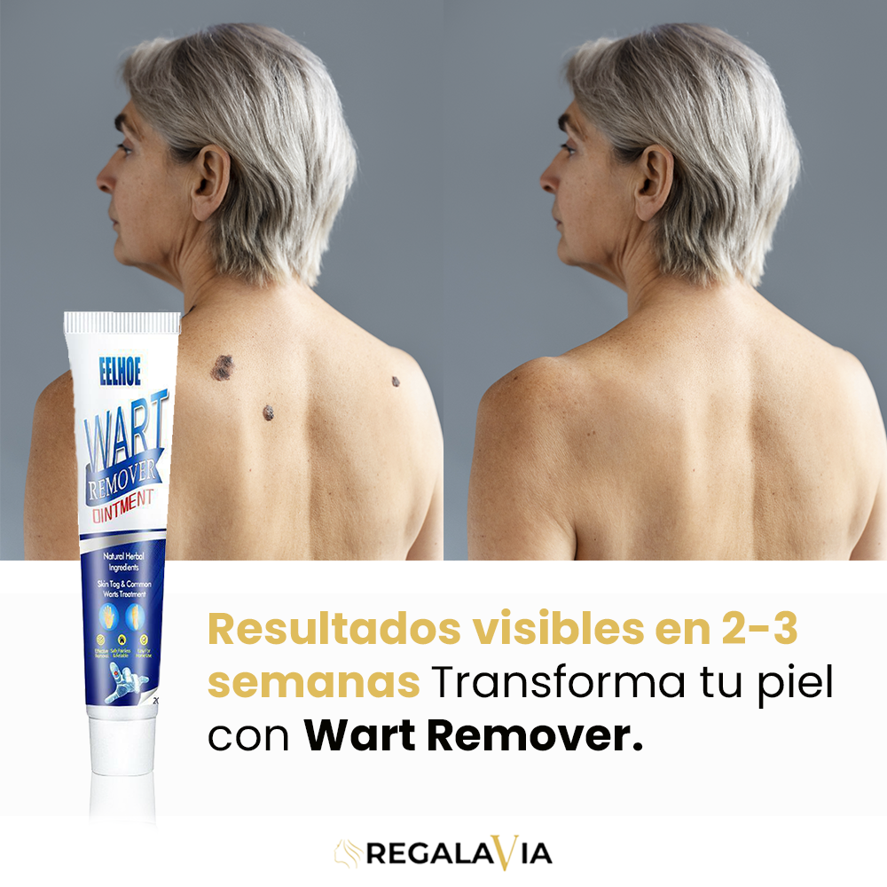 1+1 GRATIS Wart Remover™ | Eliminación Efectiva, Resultados Visibles