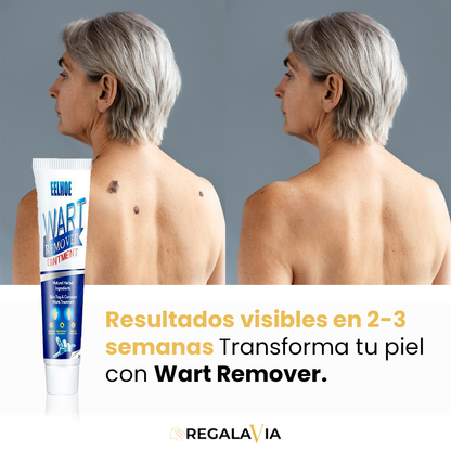 1+1 GRATIS Wart Remover™ | Eliminación Efectiva, Resultados Visibles