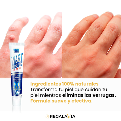 1+1 GRATIS Wart Remover™ | Eliminación Efectiva, Resultados Visibles