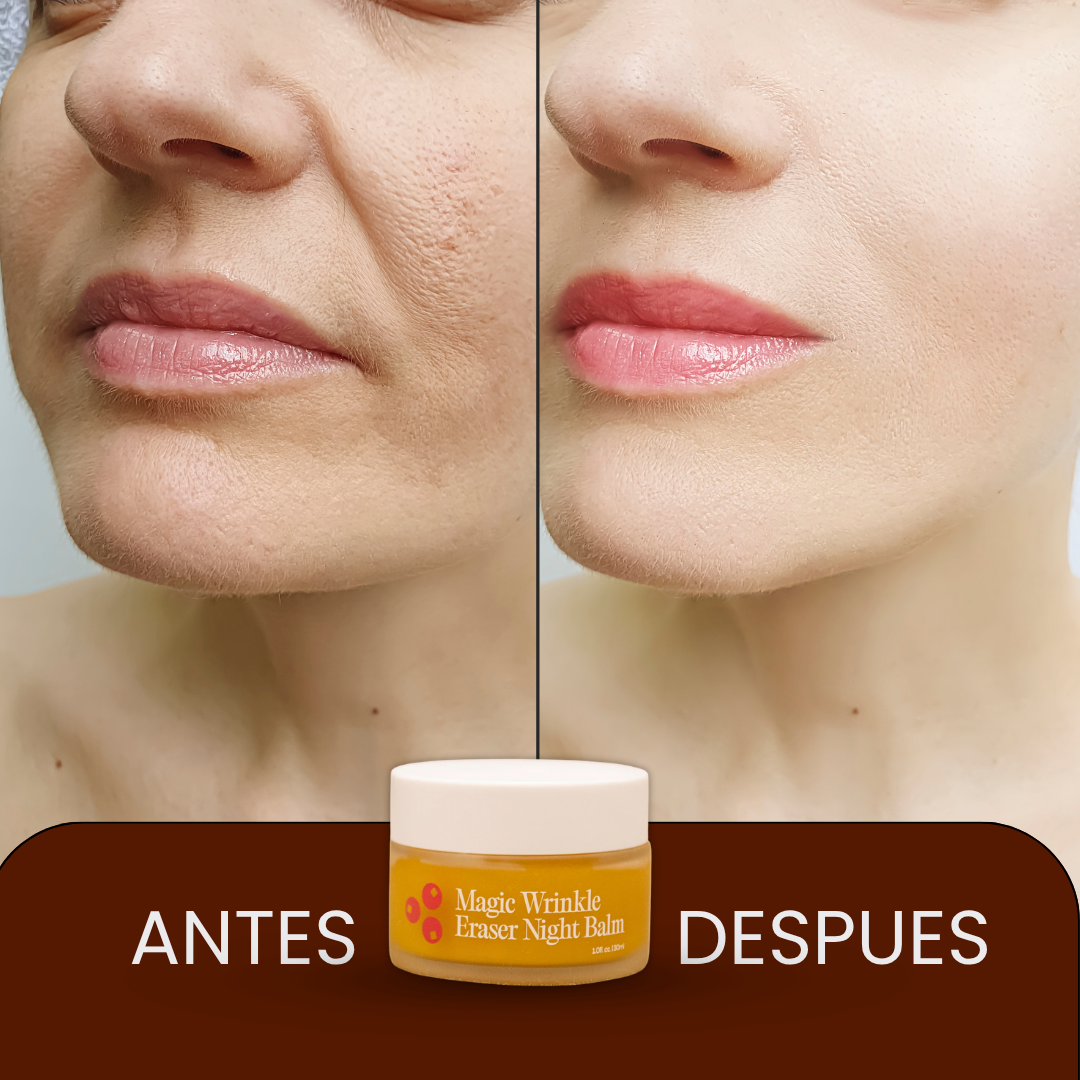 1 +1  GRATIS Magic Wrinkle Eraser ™ –  Anti Edad