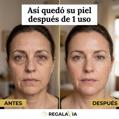 1+1 GRATIS REAL COLLAGEN FIT™ - PEEL OF MASK