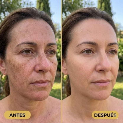 1+1 GRATIS - Zyvarn SPF50 · Protege tu piel cada día