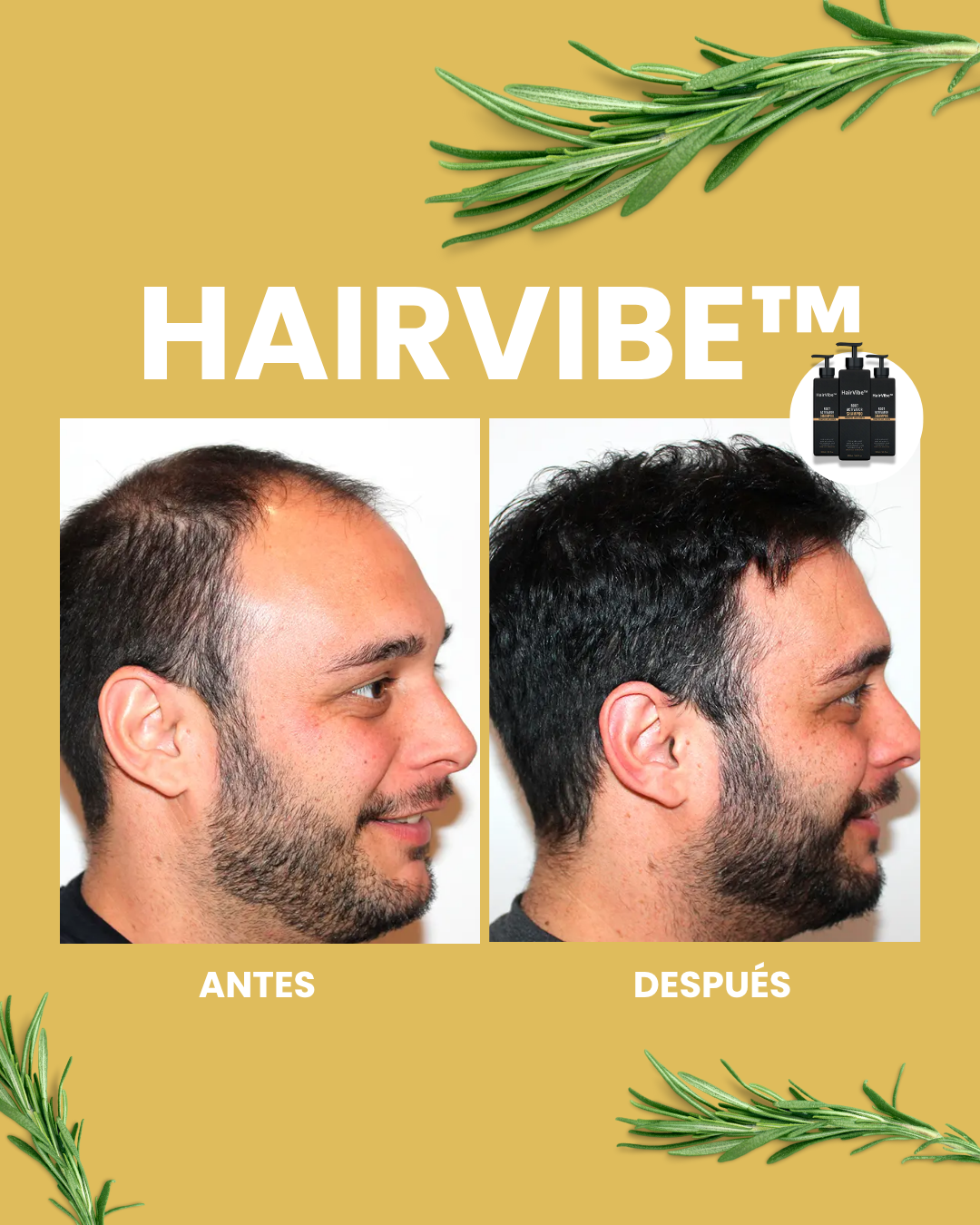 1+1 GRATIS HairVibe™ Estimula el Crecimiento Capilar